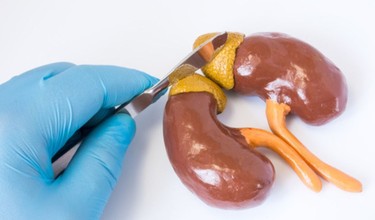 Sau mổ u tuyến thượng thận có biến chứng gì và cách chăm sóc thế nào?