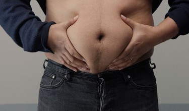 Giảm mỡ bụng dưới cho nam như thế nào? Nguyên nhân gây tích mỡ bụng