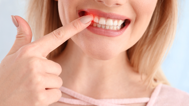 Nguyên nhân chảy máu chân răng về đêm và cách phòng ngừa hiệu quả