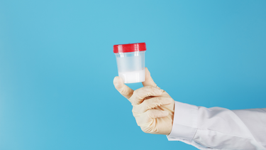 Xét nghiệm tinh dịch đồ bao lâu có kết quả, những lưu ý quan trọng?