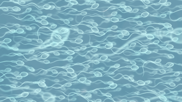 Kết quả tinh dịch đồ là gì? Các yếu tố ảnh hưởng đến kết quả