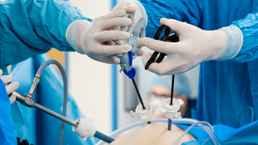 Mổ nội soi là gì? Những rủi ro và hạn chế có thể gặp khi mổ nội soi