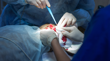 Cắt bao quy đầu có đau không và những yếu tố ảnh hưởng?