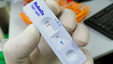Rubella IgG dương tính là gì? Ý nghĩa của kết quả xét nghiệm