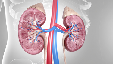 Giãn đài bể thận là gì? Nguyên nhân và dấu hiệu nhận biết 