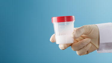 Tinh dịch vón cục là gì? Nguyên nhân, cách xử lý an toàn cho nam giới