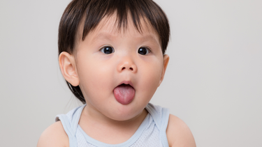 Dính thắng lưỡi độ 1 có cần cắt không? Dấu hiệu nhận biết trẻ bị dính thắng lưỡi