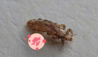 Rận mu có tự hết không? Những ảnh hưởng nếu không điều trị kịp thời