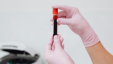 Các gói xét nghiệm NIPT hiện nay và điểm khác biệt giữa từng gói