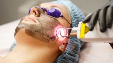 Laser CO2 Fractional là gì? Công dụng, hiệu quả và độ an toàn