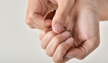 Vảy nến móng tay là gì? Dấu hiệu nhận biết và lưu ý khi chăm sóc