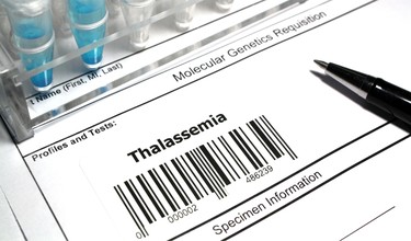Xét nghiệm gen thalassemia là gì? Đối tượng nào nên xét nghiệm?