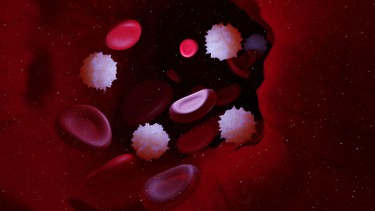 Bạch cầu cao là bệnh gì? Nguyên nhân, dấu hiệu và cách xử lý