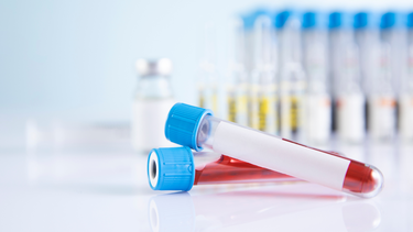 Bạch cầu tăng cao có nguy hiểm không? Dấu hiệu cần lưu ý