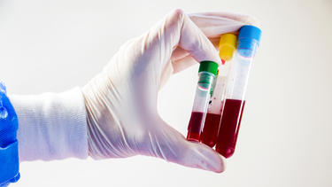 Bạch cầu trung tính giảm: Nguyên nhân, triệu chứng và cách điều trị