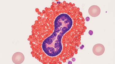 Bạch cầu ưa axit là gì? Khi chỉ số tăng cao cần hiểu đúng để không lo lắng