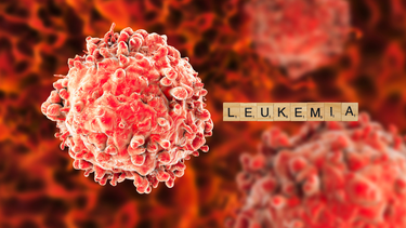 Bệnh bạch cầu: Triệu chứng, nguy cơ, cách điều trị và phòng ngừa