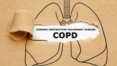 Bệnh phổi tắc nghẽn mạn tính (COPD) là gì? Nguyên nhân, triệu chứng và cách phòng ngừa