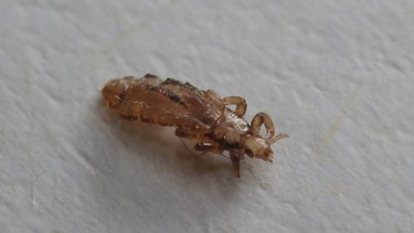 Chấy rận: Dấu hiệu, nguyên nhân, phương pháp chẩn đoán, điều trị và phòng ngừa