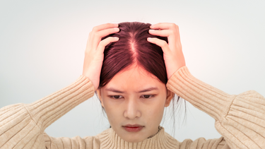 Đau đầu vận mạch: Triệu chứng, nguy cơ, cách điều trị và phòng ngừa