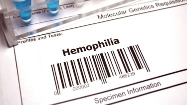Bệnh Hemophilia là gì? Nguyên nhân và cách phòng ngừa hiệu quả