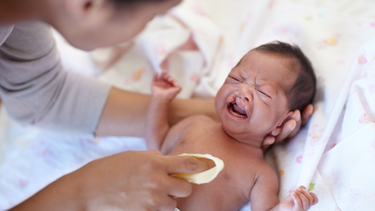 Hở hàm ếch là gì? Nguyên nhân, cách điều trị và phòng ngừa