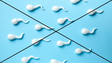 Không có tinh trùng là gì? Những điều cần biết về không có tinh trùng