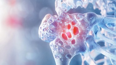 Loãng xương là gì? Nguyên nhân, triệu chứng, chẩn đoán và điều trị