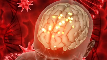 Nhiễm khuẩn huyết não mô cầu là gì? Nguyên nhân, triệu chứng và cách điều trị