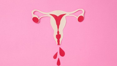 Tử cung có vách ngăn là gì? Những điều cần biết về tử cung không có vách ngăn