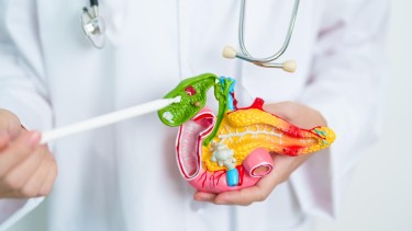 U cơ tuyến túi mật là gì? Triệu chứng, nguyên nhân và cách điều trị