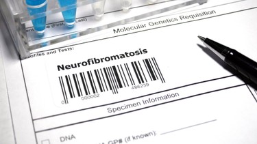 U xơ thần kinh type 1​: Dấu hiệu, nguyên nhân, phương pháp chẩn đoán, điều trị và phòng ngừa