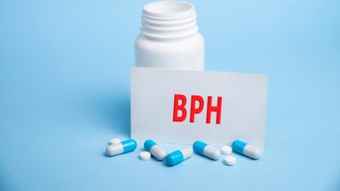 U xơ tiền liệt tuyến là gì? Nguyên nhân và cách phòng ngừa hiệu quả