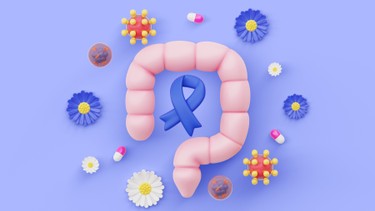 Ung thư trực tràng giai đoạn 3​ là gì? Nguyên nhân, triệu chứng và cách điều trị