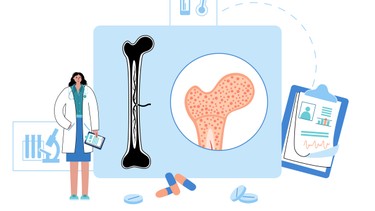 Ung thư tủy xương là gì? Nguyên nhân, triệu chứng và cách điều trị