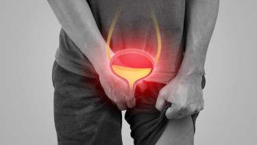 Viêm bàng quang kẽ là gì? Nguyên nhân, triệu chứng và cách điều trị