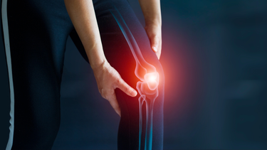 Viêm khớp là gì? Nguyên nhân, triệu chứng, cách điều trị và phòng ngừa