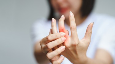 Viêm khớp ngón tay: Dấu hiệu, nguyên nhân, phương pháp chẩn đoán, điều trị và phòng ngừa