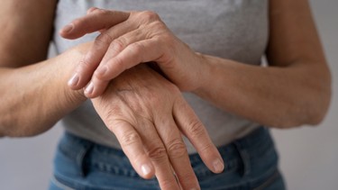 Viêm khớp tự miễn: Dấu hiệu, nguyên nhân, phương pháp chẩn đoán, điều trị và phòng ngừa