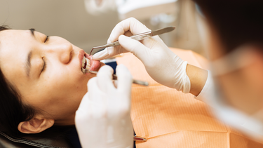 Viêm nha chu là gì? Triệu chứng, nguyên nhân, cách điều trị và phòng ngừa