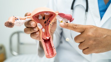 Viêm nội mạc tử cung là gì? Những điều cần biết về viêm nội mạc tử cung