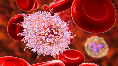 Bệnh máu trắng có chữa được không? Các phương pháp điều trị bệnh máu trắng