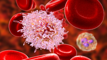 Bệnh nhân ung thư máu giai đoạn đầu có chữa được không?