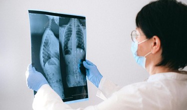 Bệnh phổi tắc nghẽn mạn tính giai đoạn 4 là gì? Có nguy hiểm không?