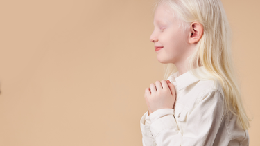 Bị bệnh bạch tạng có nguy hiểm không? Ảnh hưởng như thế nào?