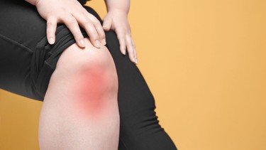 Bị cứng khớp gối sau phẫu thuật: Nguyên nhân, triệu chứng và cách phục hồi hiệu quả