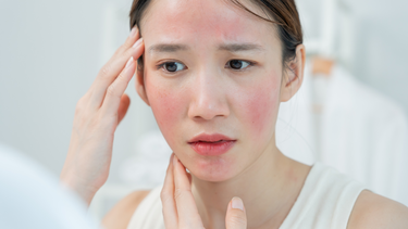 Bị dị ứng thức ăn có được tắm không? Hướng dẫn an toàn