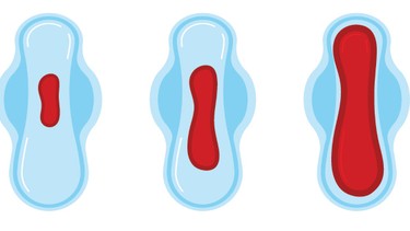 Bị rong kinh bao lâu thì hết? Cách điều trị hiệu quả