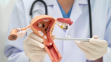 Bị u bì buồng trứng có thai được không?