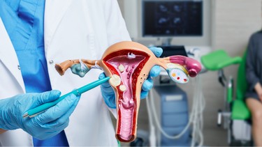 Bị u xơ tử cung có nên mổ không? Những trường hợp bắt buộc phải can thiệp